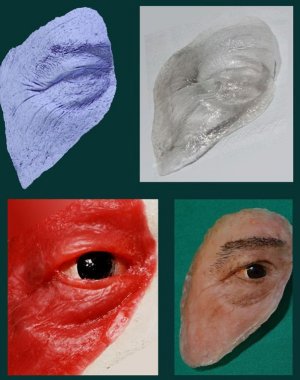 Prtese de baixo custo para implante facial  desenvolvida no Brasil