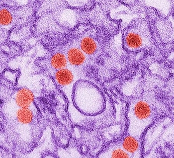 USP desenvolve exame especfico para diagnstico de zika