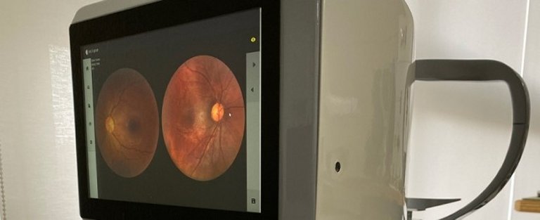 Aparelho de exame ocular inovador  desenvolvido no Brasil