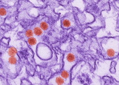 Medicamento experimental evita microcefalia causada pelo vrus zika