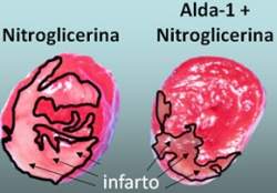 Nitroglicerina  aliada do corao contra infartos