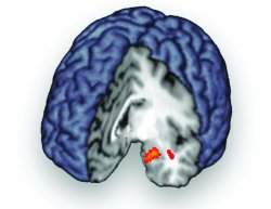 Crebro libera analgsico natural durante a 