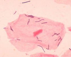 Bactria vaginal produz novo tipo de antibitico