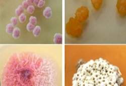 Bactrias de ambientes extremos so esperana de novos medicamentos