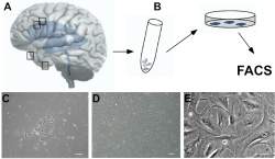 Encontradas clulas-tronco no crebro humano adulto