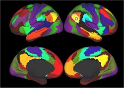 Tcnica computacional identifica regies neurais relacionadas com o dficit de ateno