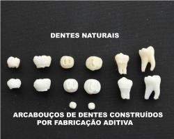 Dente artificial pode acabar com dentaduras