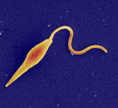 Fator que influi no desenvolvimento do cncer tambm est presente nas doenas parasitrias