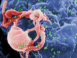 Vacina mltipla contra AIDS produz resultados modestos