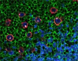Nanopartculas coloridas identificam clulas raras de cncer