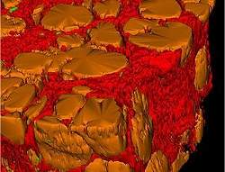 Imagens virtuais de tecidos mostram doenas em 3D