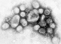 Brasil ter exame para detectar gripe A (H1N1) na prxima semana