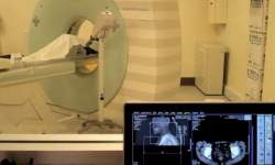 Especialistas alertam sobre riscos da radiao durante tomografias computadorizadas