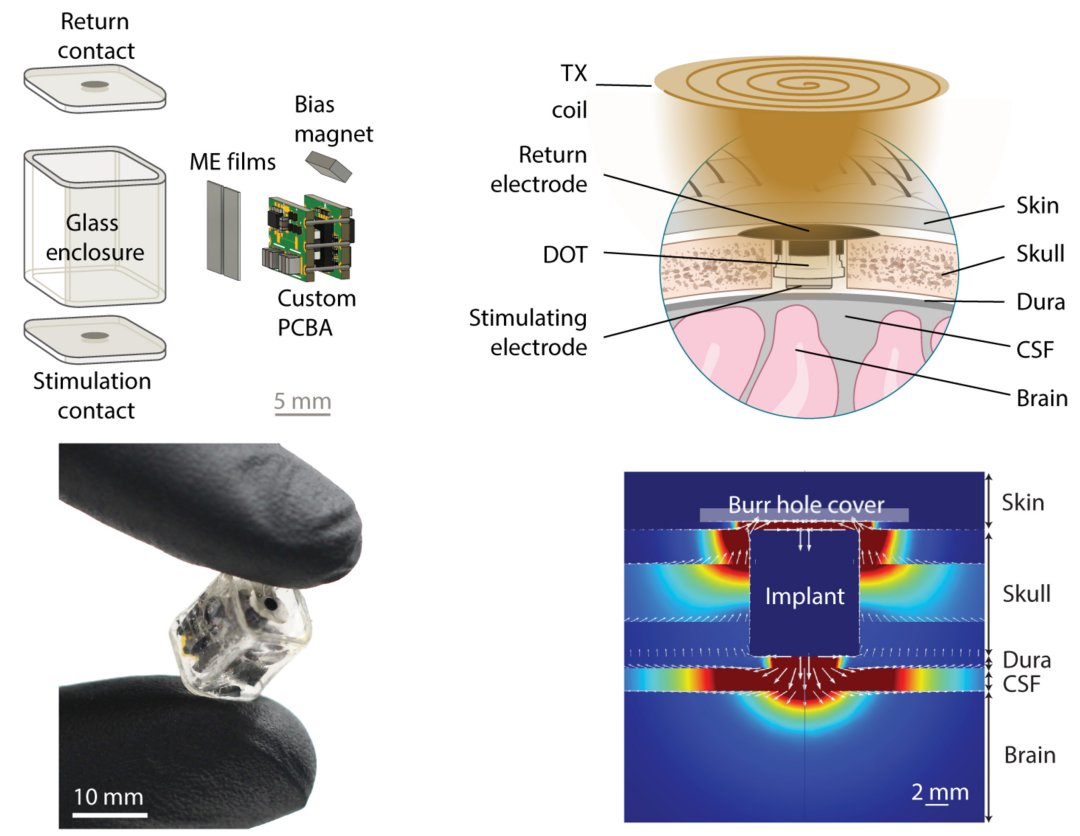 Estimulador cerebral miniaturizado e sem fios  testado em humanos