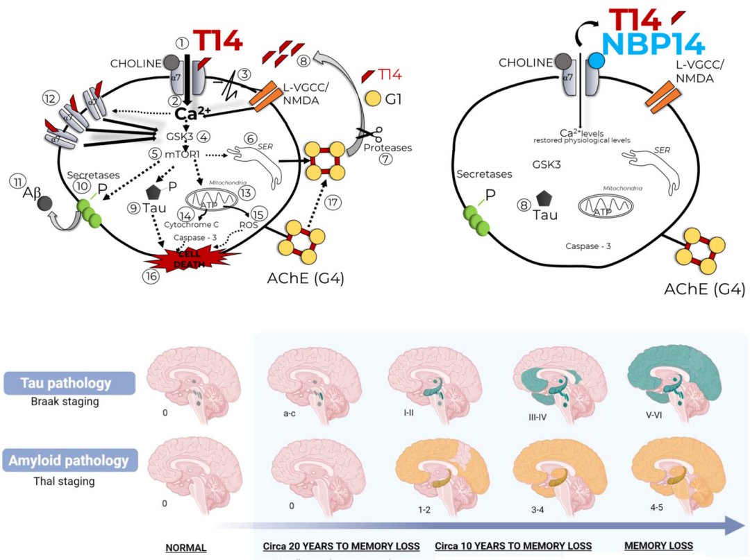 Alzheimer: Cientistas propõem uma nova perspectiva sobre a doença