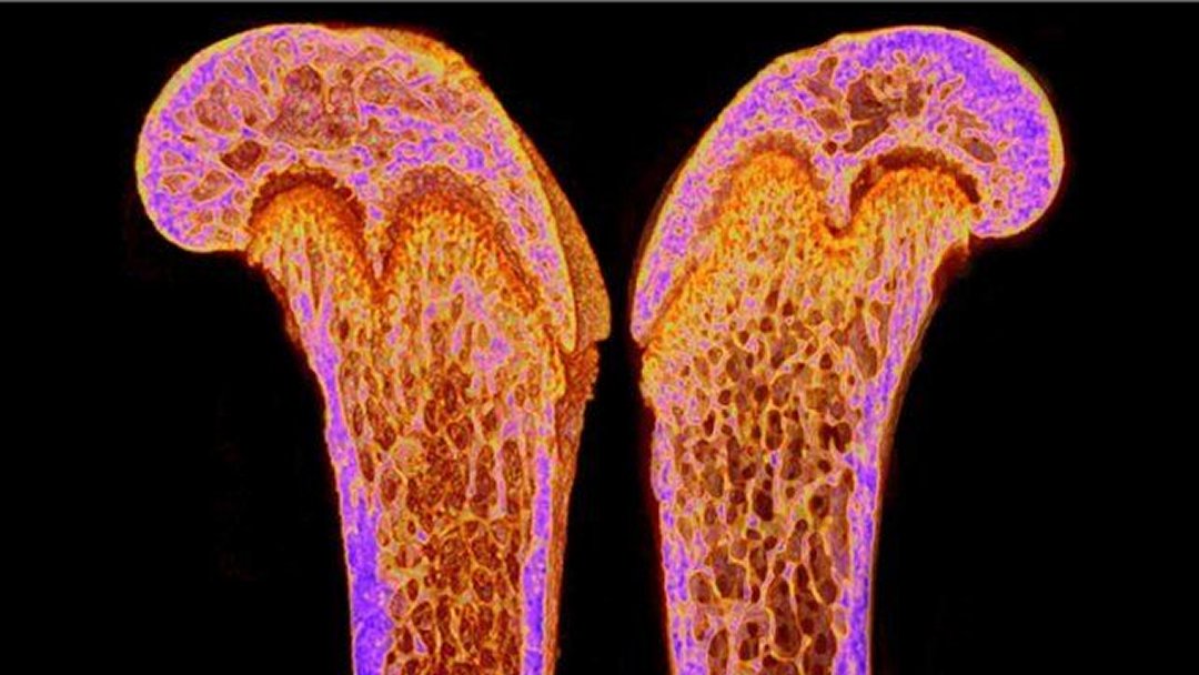 Descoberto hormnio que mantm ossos fortes quando mulheres amamentam