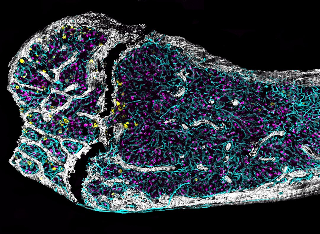 Envelhecimento  visto em nvel celular na medula ssea