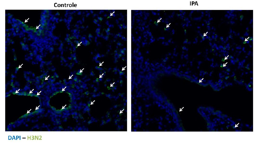 Substncia produzida no intestino protege contra gripe